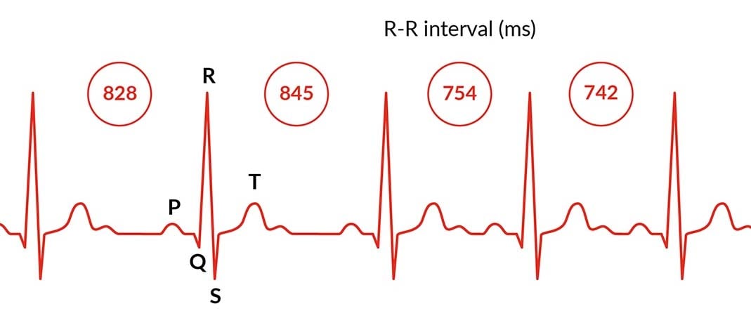 HRV Status Garmin Technology